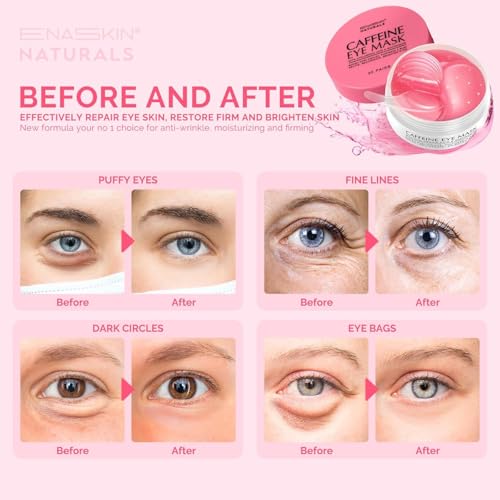 Under Eye Patches Kit: 120 Pcs Retinol & Caffieine Gel Eye Mask for Dark Circles, Puffiness and Wrinkles - Day & Night Skin Treatment Pads with Niacinamide, Collagen & Hyaluronic Acid (2 Pack)
