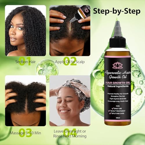 Lifewithqueenp Hair Care Growth Oil, Ayurvedic Hair Growth Oil, Lightweight Natural Herbs Scalp Oils for All Hair Types (1)