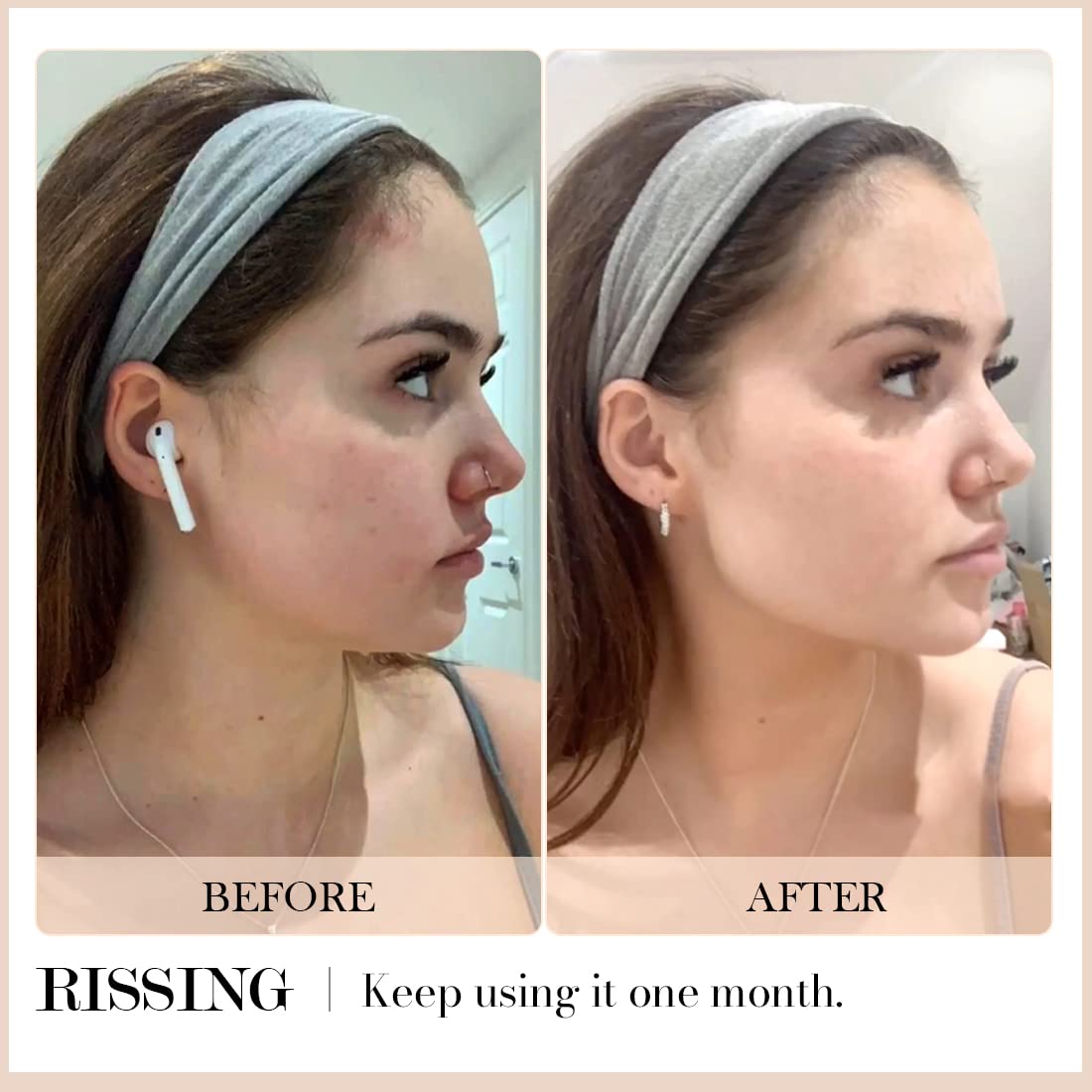 RISSING 4-in-1 Gua Sha Facial Tools: Lymphatic Drainage Massager Facial Roller for Wrinkles and Lifting, Stainless Steel Gua Sha Tool for Face, Skin Care Tools Eye Roller (Luxury Gift Box Edition)