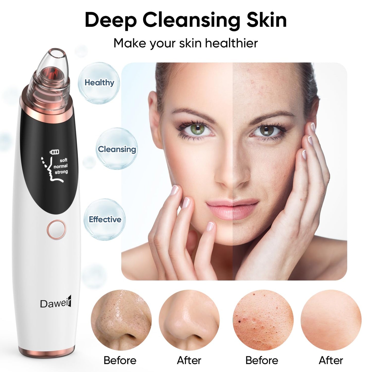 Daweir Blackhead Remover Pore Vacuum - Pimple Extractor Tools Pore Cleaner toolfor Face & Nose