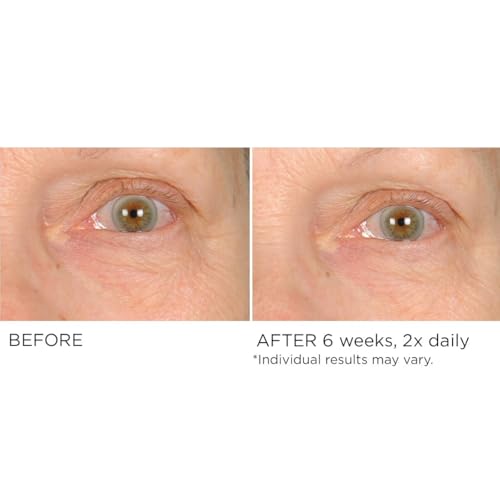 NassifMD Under Eye Anti-Aging Smoother Puffiness Dark Circles Eye Primer