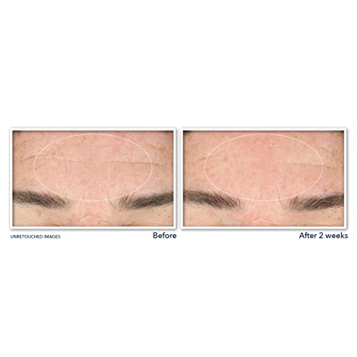 RoC Derm Correxion Serum Facial Cleanser with Niacinamide and Amino Acids