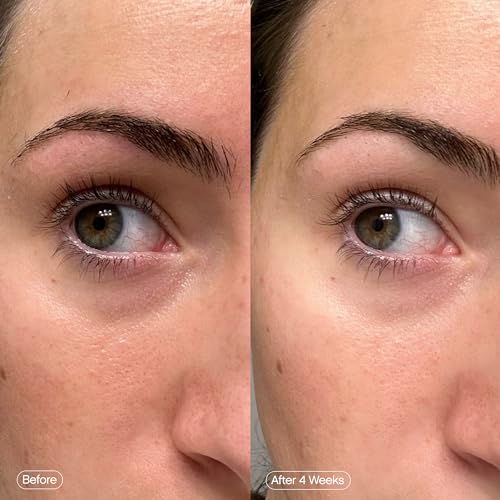 Topicals, Faded Brightening Under Eye Masks, Depuffs & Brightens, Set of 6
