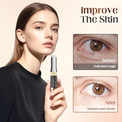 Under Eye Balm Stick for Under Eyes Bags,2025 New Turmeric Cream Erases Eyes Bags Within Minutes,Erase for Dark Circles Puffiness,Moisturizing Under Eye Balm for Travel Care Serum for Women(2PCS)