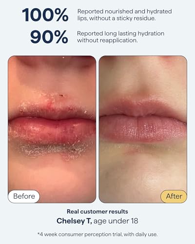 REMEDY for Dry Lips, All-In-One Hydrating Lip Treatment with Ceramides