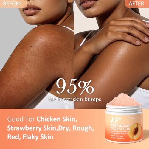 SHVYOG KP Bump Eraser Body Scrub with 10% AHA+BHA & Glycolic Acid, Exfoliating Body Scrub for Chicken & Strawberry Skin, Helps Reduce Skin Bumps, Soothe Rough Redness, Ingrown Hair, Peach Scent 7 Oz