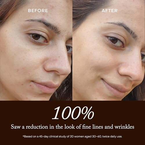 True Botanicals Renew Pure Radiance Oil | Anti-Aging Face Oil with Rosehip | Reduces Appearance of Fine Lines & Wrinkles | Deep Hydration | Dermatologist Tested, Vegan, All Natural |1 fl oz | 30 ml