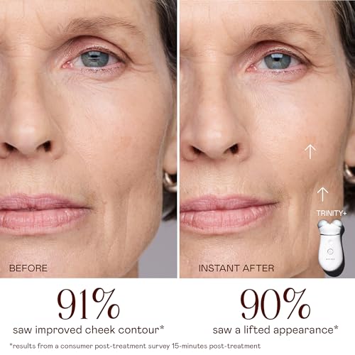 NUFACE Trinity+ Facial Massager - Face Firming & Toning Device for Lines & Wrinkles Treatment - FDA-Cleared Wrinkle Reducer + Lip & Eye Attachment + Aqua Gel Activator - 3 Frequency Microcurrent