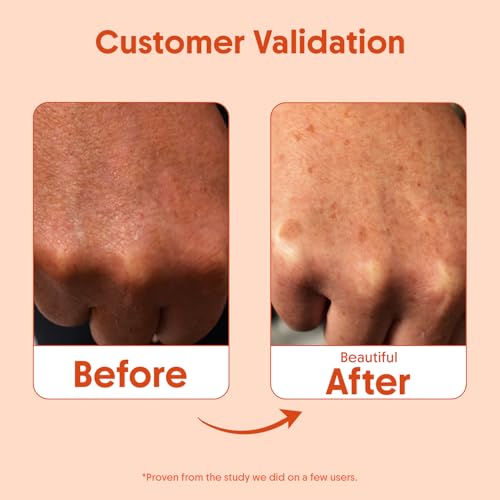 Aravi Organic Daily Oil-Free Body Sunscreen Lotion SPF 50 Broad Spectrum 80-Min Water Resistant | Niacinamide + Hyaluronic Acid + Copper Peptide | Reef Safe Vegan Oxybenzone Free | 6.76 Fl Oz