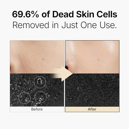 MANYO Galactomy Enzyme Peeling Gel, Gentle Face Exfoliator, 2.5 fl oz