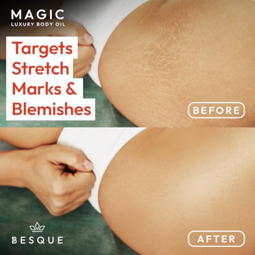Besque Original Magic Body Oil - Hydrating Body Oils for Women - 3.4 FL OZ