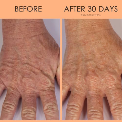BODY FIRM Crepe Erase Hand Repair Treatment, Lotion, 3 fl oz