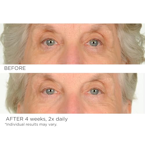NassifMD Under Eye Anti-Aging Smoother Puffiness Dark Circles Eye Primer