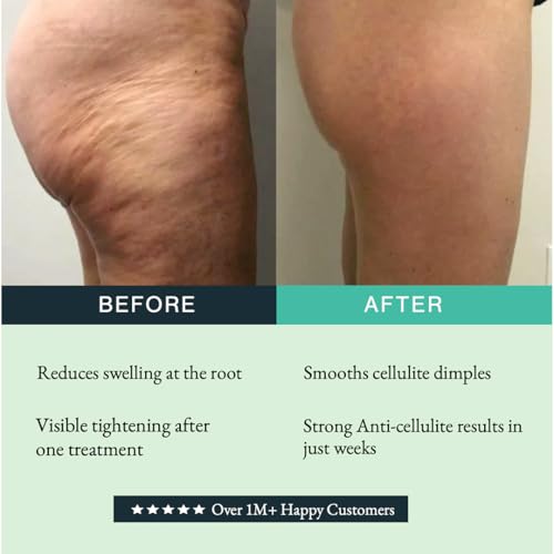 GUAM Anti-cellulite Mud COLD FORMULA, Seaweed Body Wrap for Cellulite, Skin Tightening Clay for Body Cellulite and Leg Swelling, Lymphatic Drainage | Cellulite Removal Treatment (1.1 LB)