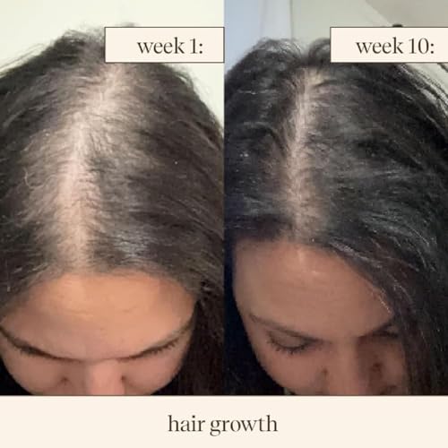 Hair Oil, 100ml, Ayurvedic Treatment with Amla, Brahmi, Bhringraj, Almond Oil for Hair Growth and Nourishment