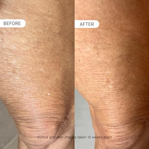 oneskin OS-01 BODY Topical Supplement Moisturizer | Age Reversal, 8.45 Oz