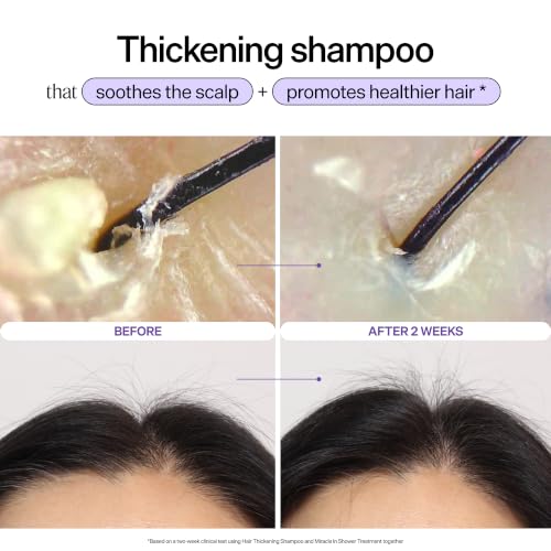 Dr. Groot Hair Thickening Shampoo, Korean Hair Care with Biotin, Rosemary Oil to Help Volumize Thinning, Damaged Hair, Hydrate Hair and Scalp, Biotin Shampoo, Scalp Revitalizing Solution