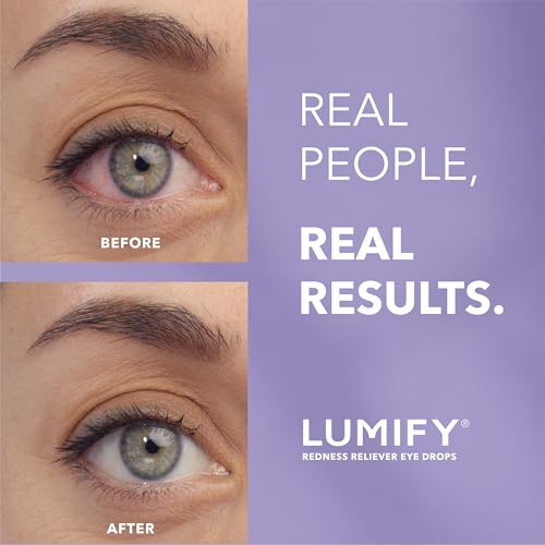Lumify Redness Relief Eye Drops, Whiter & Brighter Looking Eyes, 0.25 oz