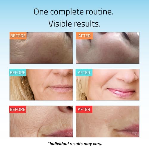 YEOUTH 8-Piece Full Size Skin Care Set for Visibly Smoother-Looking Skin