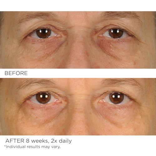 NassifMD Under Eye Anti-Aging Smoother Puffiness Dark Circles Eye Primer