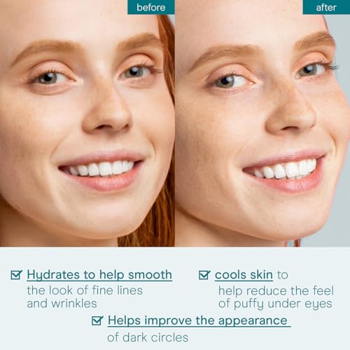 Baebody Cooling Under-Eye Gel for Dark Circles and Puffiness, 1.7 fl oz