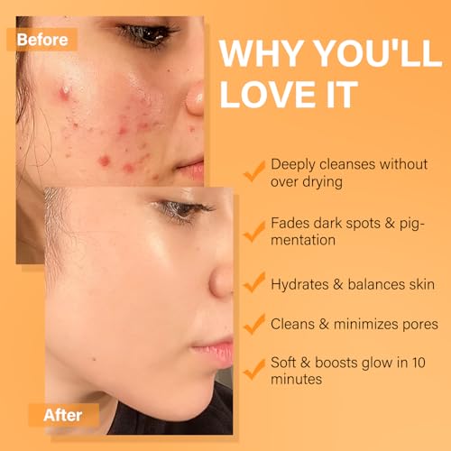Facial Clay Mask Set - Vitamin C Turmeric Face Mask, Dead Sea Mud & Salicylic Acid (BHA) Mask for Pore Cleansing, Brightening, Blackheads & Dark Spots, Face Masks Skincare Gift for Women, 2.82 oz each