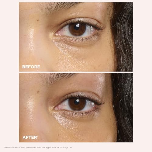 Clarins Total Eye Lift | Anti Aging Eye Cream | Targets Wrinkles, Crow's Feet, Dark Circles and Puffiness For a Visible Eye Lift in 30 Seconds