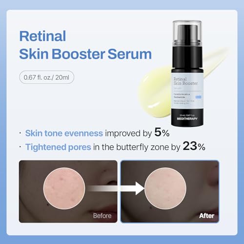 MEDITHERAPY Gentle Boost Kit – Korean Skin Care Set with Retinal & Hyaluronic Acid Serum & Squalane Moisturizer, Anti-Aging & Hydrating Routine, Beginner-Friendly, Travel & Gift