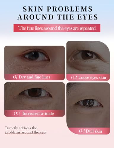 NORNI LEORD 80 PCS Under Eye Patches for Puffy Eyes and Dark Circles