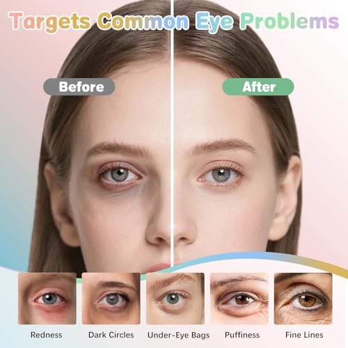 120 Pairs Under Eye Patches,Hydrating Eye Mask For Puffy Eyes &Dark Circles