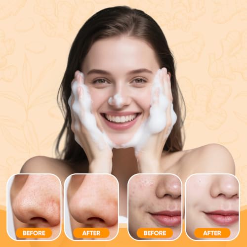 Turmeric Face Wash Set, Turmeric Facial Cleanser & Turmeric Soap Bar & Oil
