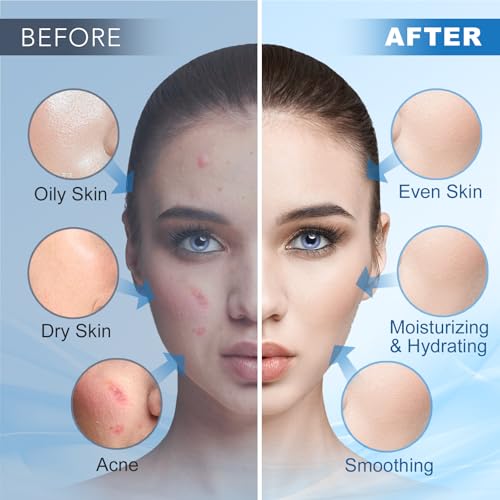 Angeland Jelly Mask for Facials Professional, Hydrating & Moisturizing Peel-Off Natural Gel Face Mask SkinCare, Professional Spa Use Jelly Face Masks, Deep Hydration & Glow 23 Fl Oz (Hyaluronic Acid)