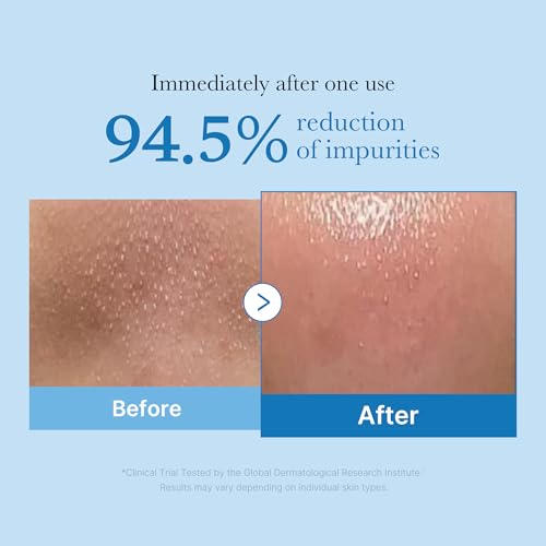 medicube Cleansing Oil Zero Pore Blackhead