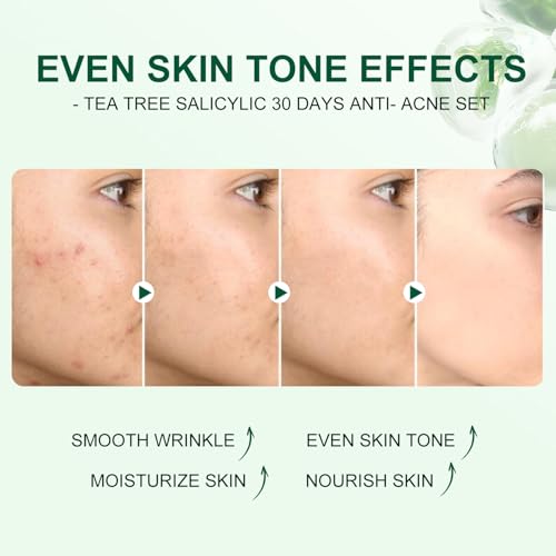 Tea Tree Salicylic Acid Facial Skin Care Set, Acne Treatment Skincare Set ,Skincare Mini Kit, Facial Kit Gifts for Women,Cleanser, Toner, Serum, Cream,Oil Control Facial Kit, Travel Size Set