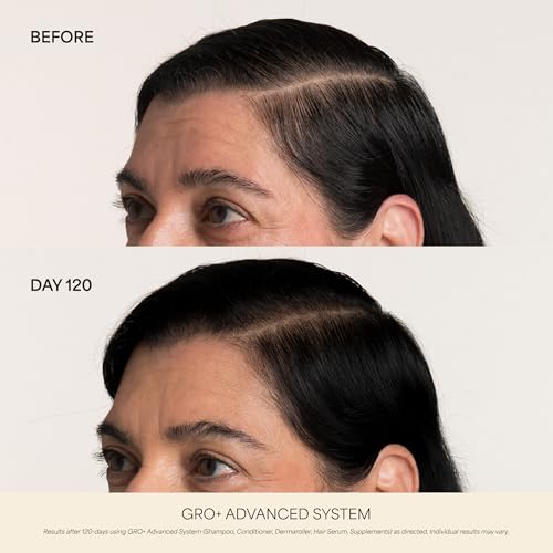 VEGAMOUR GRO+ Advanced Gel-Serum Pen, MD-Formulated - Cooling Massage Applicator, Drip-Free, Reduces Shedding & Breakage, Targeted Areas, Vegan & Cruelty-Free