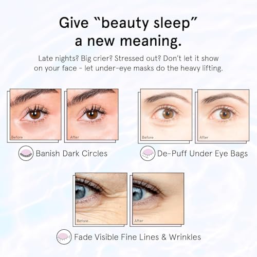 grace & stella Retinol Under Eye Patches for Puffy Eyes
