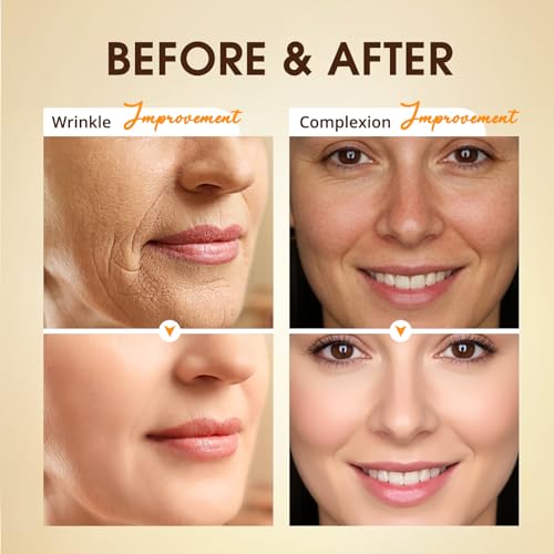 BIYSBER Retinol Collagen Serum for Face: Anti Aging &Anti Wrinkle Repair Peptide Serum with Hyaluronic Acid Boost Hydration-Day/Night Facial Firming Lifting Neck Skin Care for Women/Men(1.70 Fl Oz)