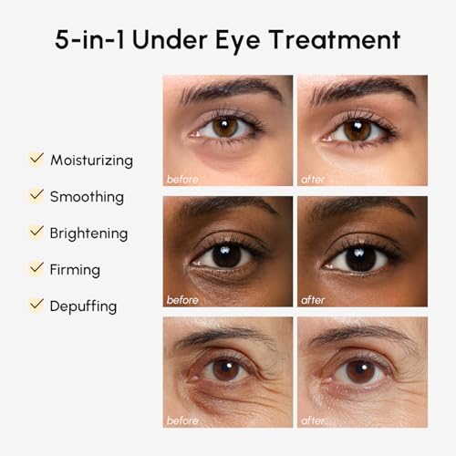 MAREE Under Eye Balm Stick Hydrating – Retinol Caffeine Under Eye Brightener Stick for Older Women – Collagen Undereye Cream for Dark Circles & Wrinkles – 0.28 Ounce, Gold