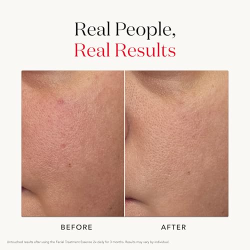 SK-II Facial Treatment Essence - Anti-Aging Essence Skincare to Help Reduce the Appearance of Fine Lines & Wrinkles - Visibly Refines Texture & Improves Firmness & Dark Spots (7.7 oz)