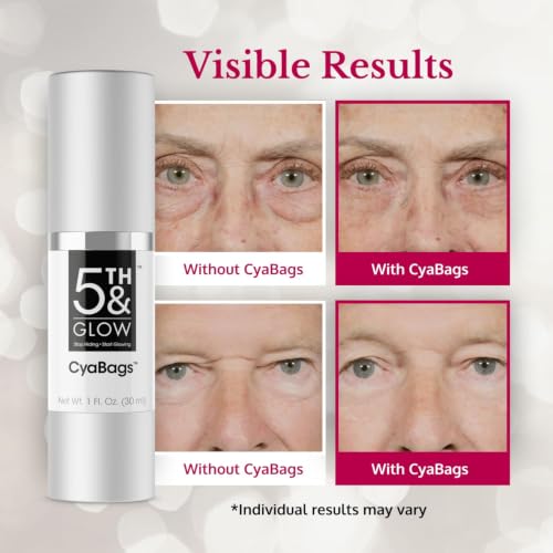 5th & Glow Cyabags - Instant Puffy Eyes Reduction & Under Eye Bag Remover Serum For Women - Hyaluronic Acid & Vitamin C Cream for Fine Lines, Wrinkles & Crowsfeet, 1 oz