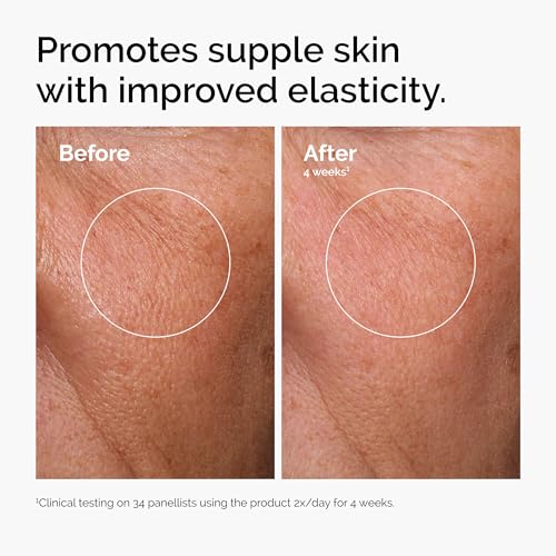 The Ordinary Serum Favorites Set – Hyaluronic Acid 2% + B5, Niacinamide 10% + Zinc 1%, Caffeine Solution 5% + EGCG Eye Serum, Serums for Hydrating, Brightening & Pore-Minimizing Skin Care