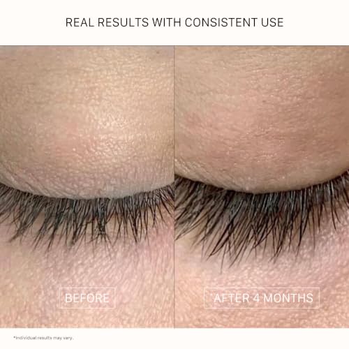 ACTIIV Amplify Lash + Brow Serum | Promotes Thicker Fuller Lashes & Brows, Strengthens & Nourishes Hair Follicles, Lightweight Formula, Vegan, Plant-Based, All Hair Types, 5 mL / 0.16 oz