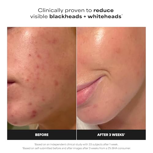 Paula's Choice SKIN PERFECTING 2% BHA Liquid Exfoliant, 1 Fl Oz
