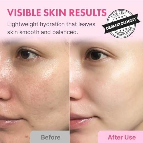 Hanskin Hyaluron Skin Essence, Hyaluronic Acid Toner, Dry Skin, 5.07 fl oz