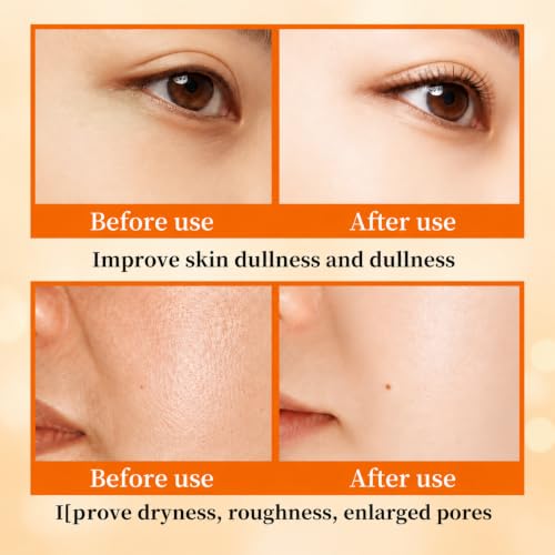 Vitamin C Niacinamide Skincare Set, Daily Facial Care Routine with 6-Piece