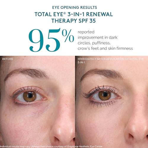 Colorescience, Total Eye 3-in-1 Renewal Therapy, SPF 35, Medium