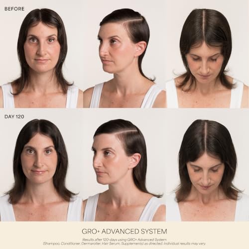 VEGAMOUR GRO+ Advanced Hair Serum, 3-Month Supply - MD-Formulated, Reduces Shedding & Breakage, Fuller-Looking Hair, Balanced Scalp, Non-Oily, Vegan & Cruelty-Free