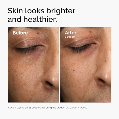 The Ordinary Multi-Antioxidant Radiance Serum, Vitamin C Serum For Face, Brighten & Protect Skin – Boosts Glow & Shields Against Environmental Stressors, 1 Fl Oz