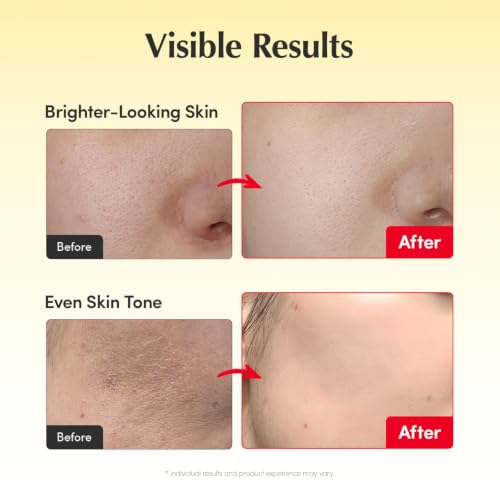 EQQUALBERRY Vitamin C Dark Spots & Brightening Duo | Vitamin Illuminating Serum & Cream with Niacinamide, TXA & Ceramides | Korean Skincare Set for Even Tone & Glow