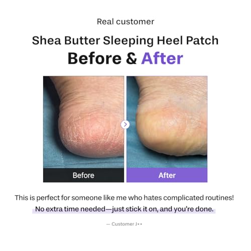 Baren Shea Butter Heel Patch, Overnight Cracked Heel Foot Mask, 6pcs